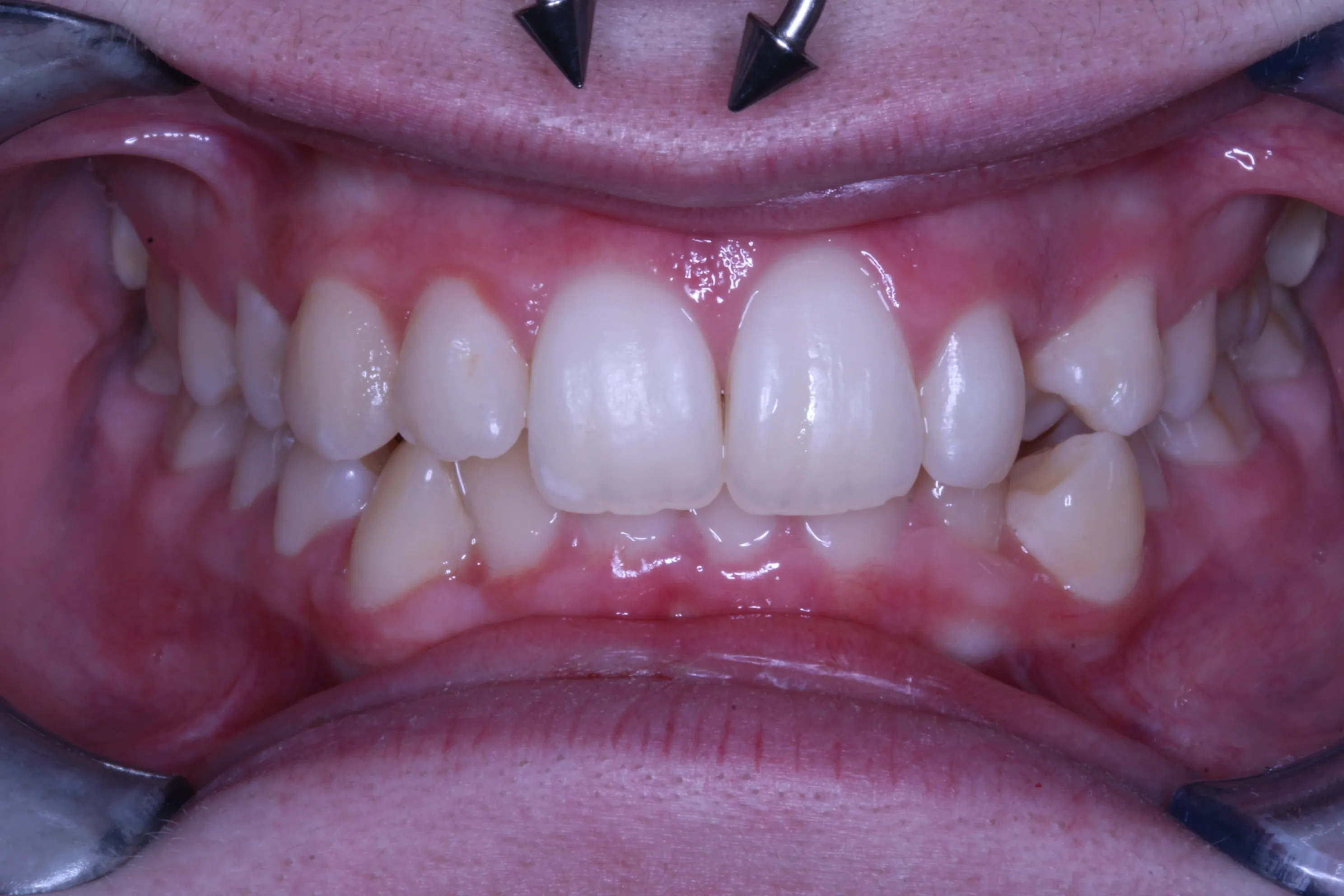 smile-gallery gallery